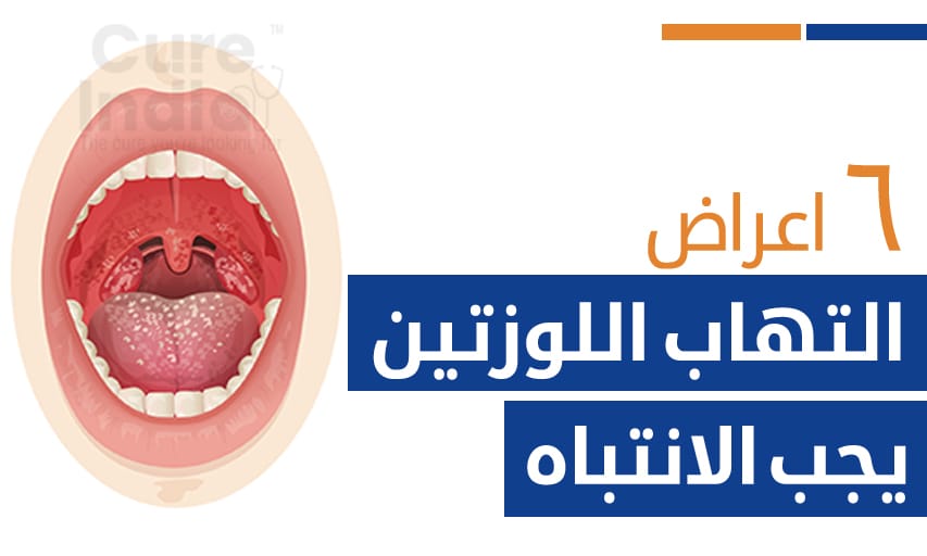 ٦ اعراض التهاب اللوزتين يجب الانتباه وعدم التجاهل